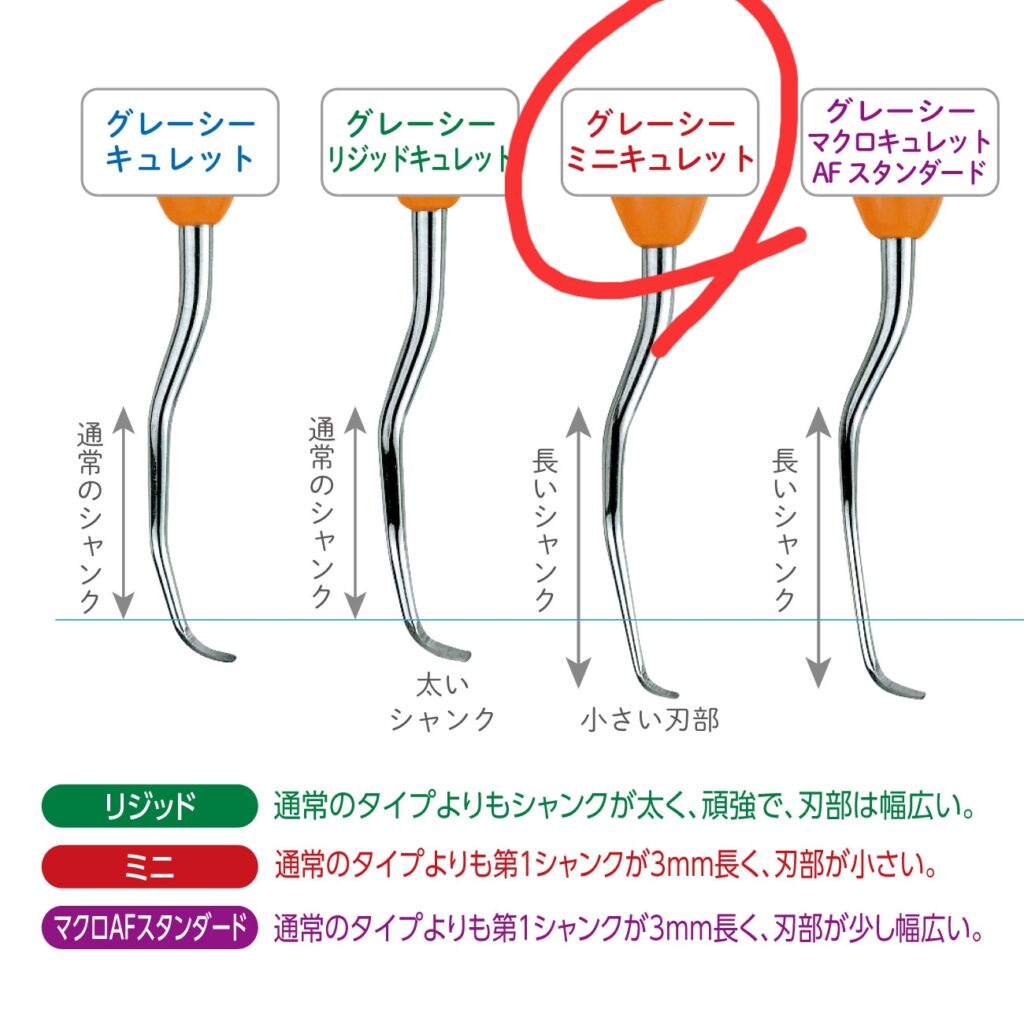 グレーシーキュレット 11／12 4本セット - その他